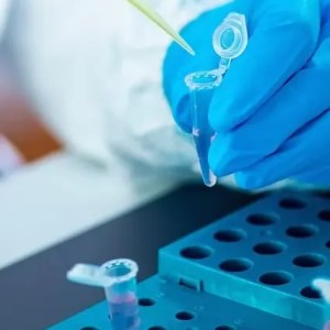 Scientist working in a lab, who is looking at samples.